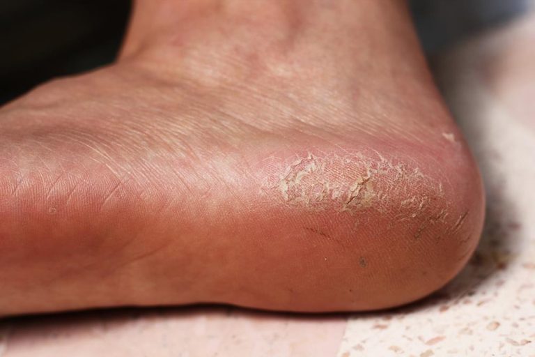 About Reliant Foot & Ankle Specialists PLLC